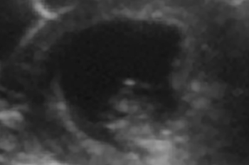 下から縦方向に撮影　10週6日