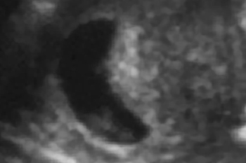 下から縦方向に撮影　9週0日