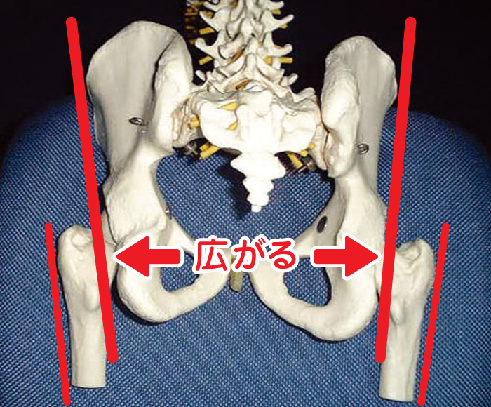すそ広がりの骨盤（ずん胴型）