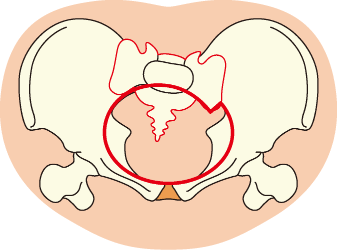 でっぱりがあると