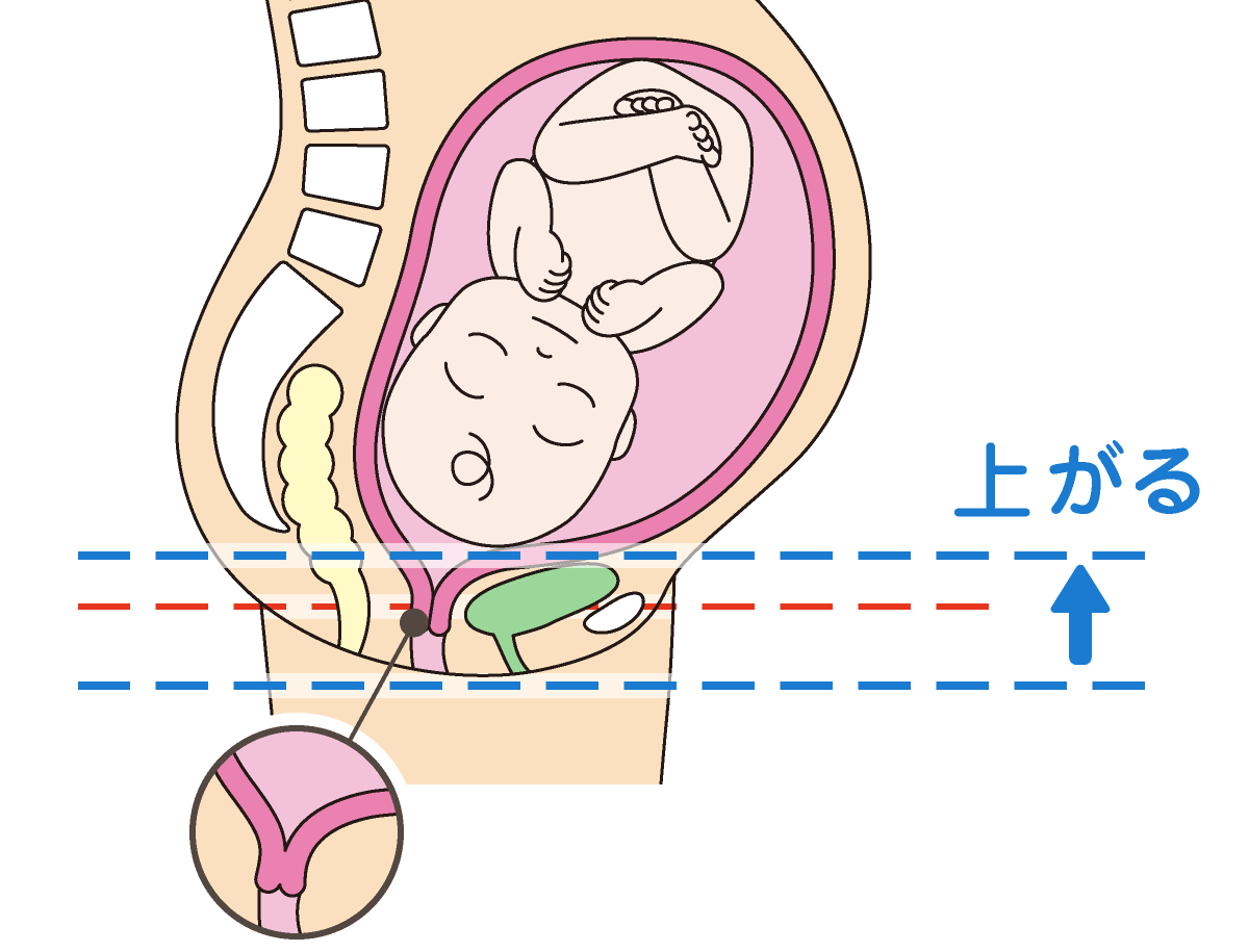 子宮が下がらない