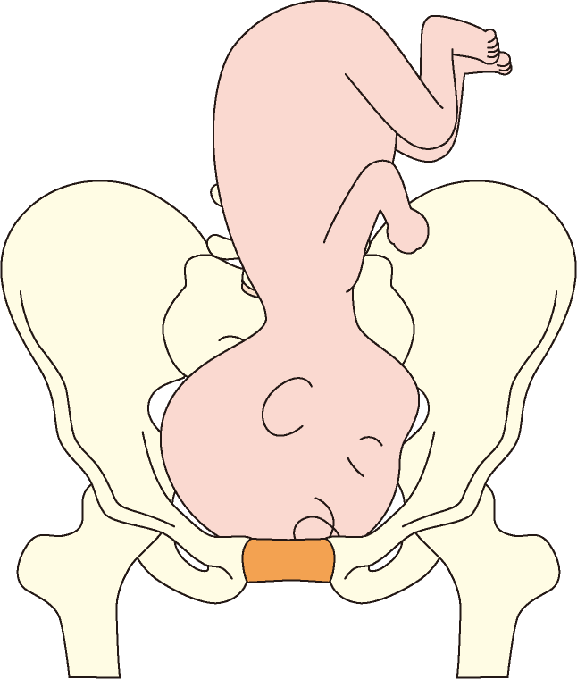 あごを引いていない